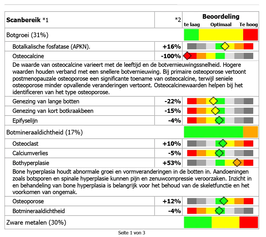 Voorbeeld van een rapport van de Corpus Analyzer met balken van te laag tot te hoog per onderdeel